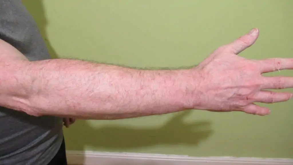 A man displaying his 13 inch forearm