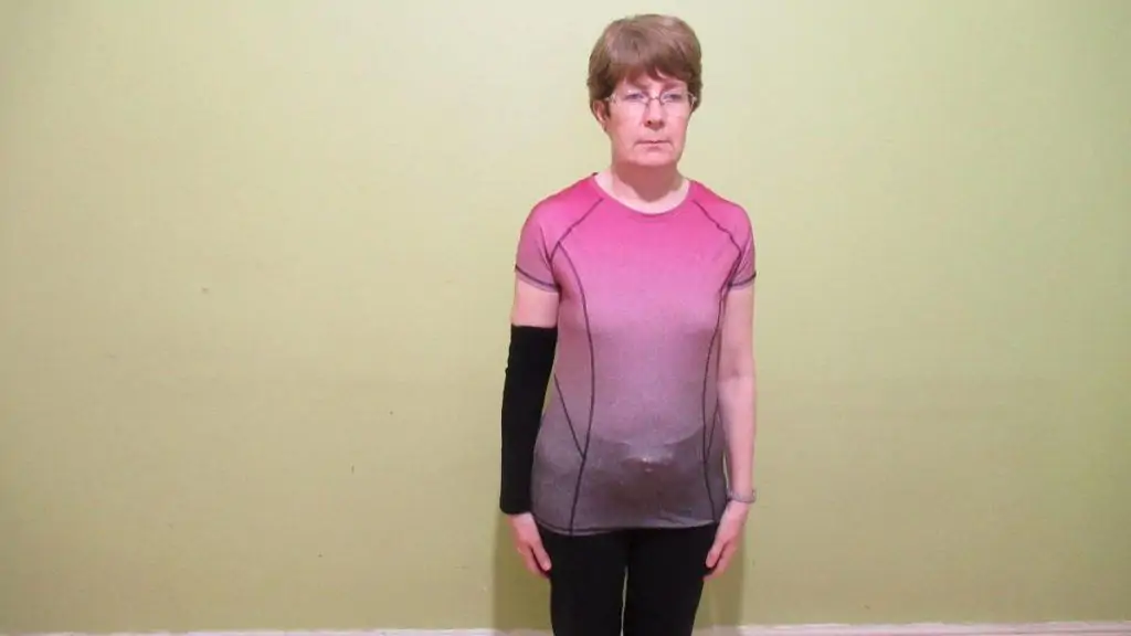 A woman wearing a compression sleeve for her wrist and forearm