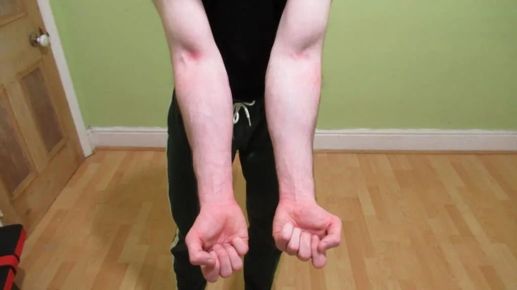 A man showing his forearms