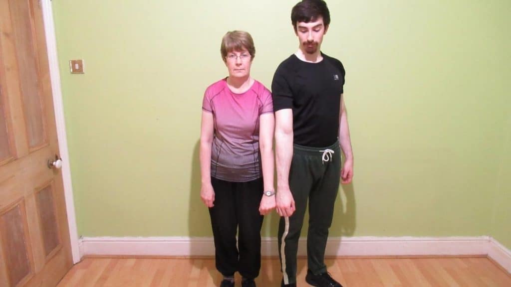 A man and a woman showing their forearms