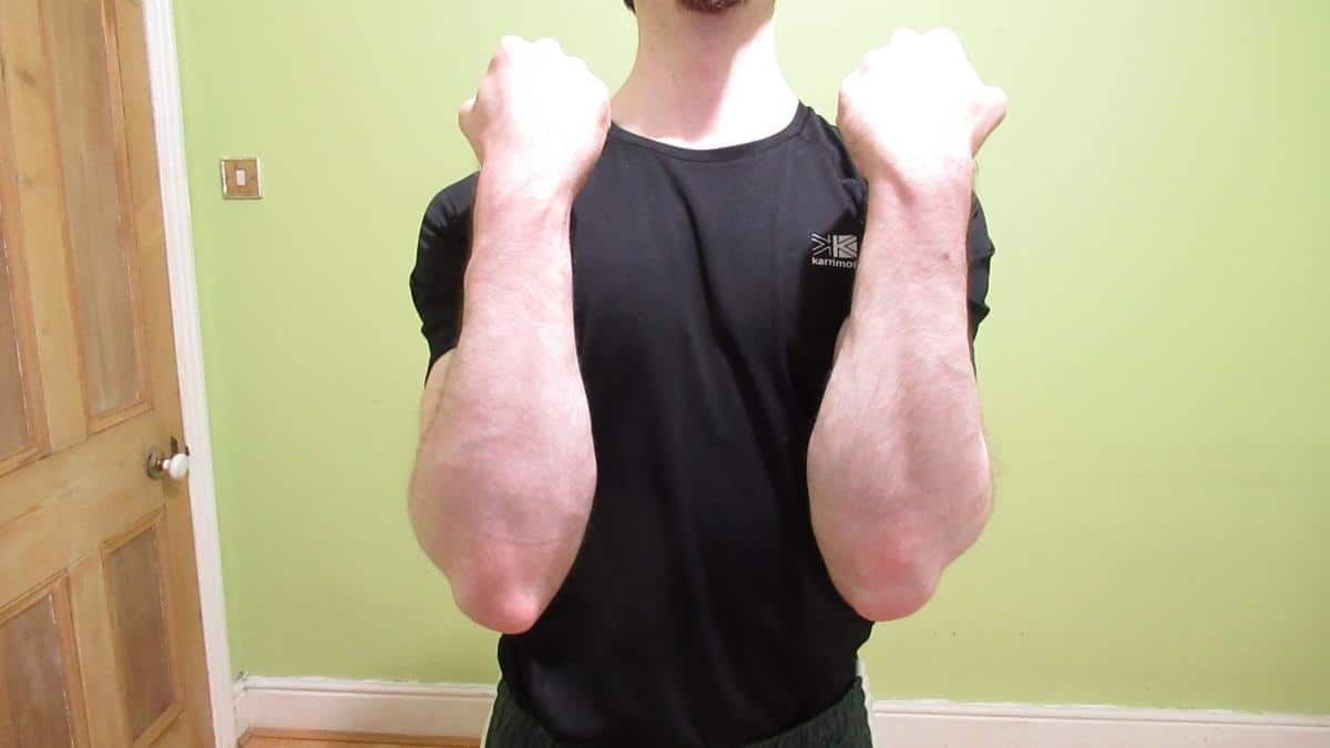 A man showing that he has one forearm bigger than the other