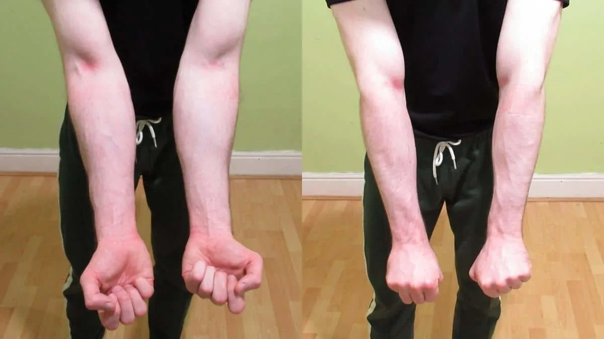 A man showing the opposite of forearm (the extensors and flexors)