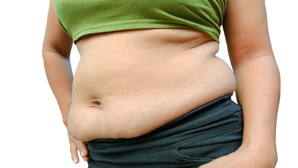 Close up of an overweight woman's 52 inch waist