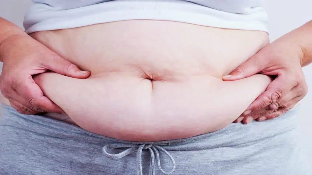 A woman grabbing the fat on her 58 inch belly