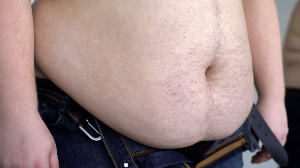 Close up of an obese man's 65 inch belly
