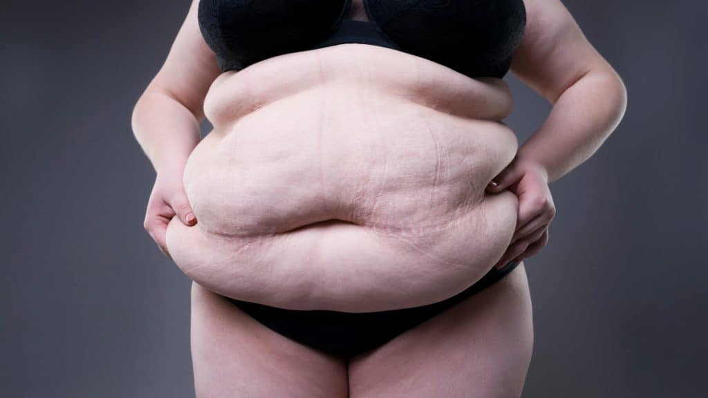 An obese woman squeezing the fat on her 85 inch waist