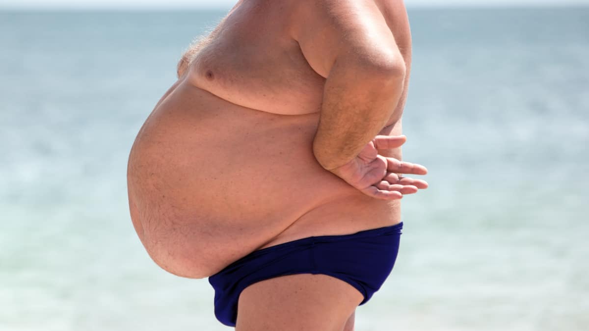 An obese man with a 90 inch waist at the beach