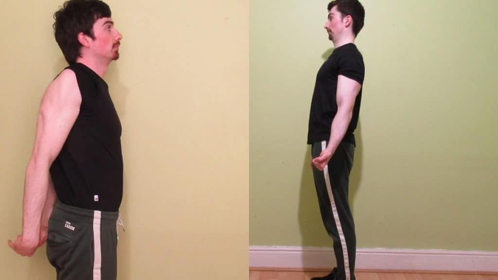 A man demonstrating that his triceps are lagging in comparison with his other arm muscles