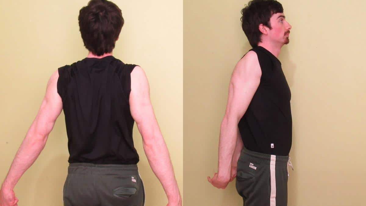 A man showing that he has relatively weak triceps