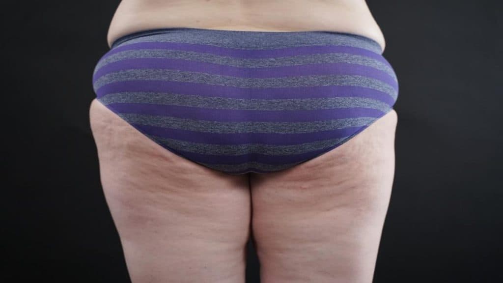 An obese lady showing her 25 inch booty
