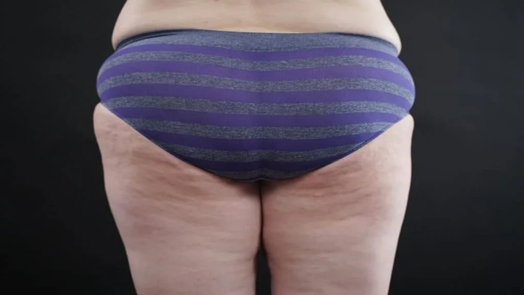 A woman showing her 26 inch booty