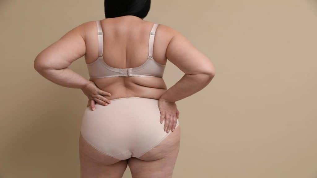 An obese woman showing that she has 53 inch hips