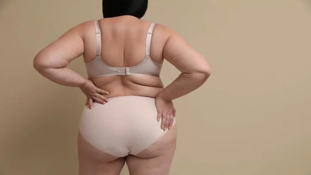 An obese woman showing that she has 53 inch hips