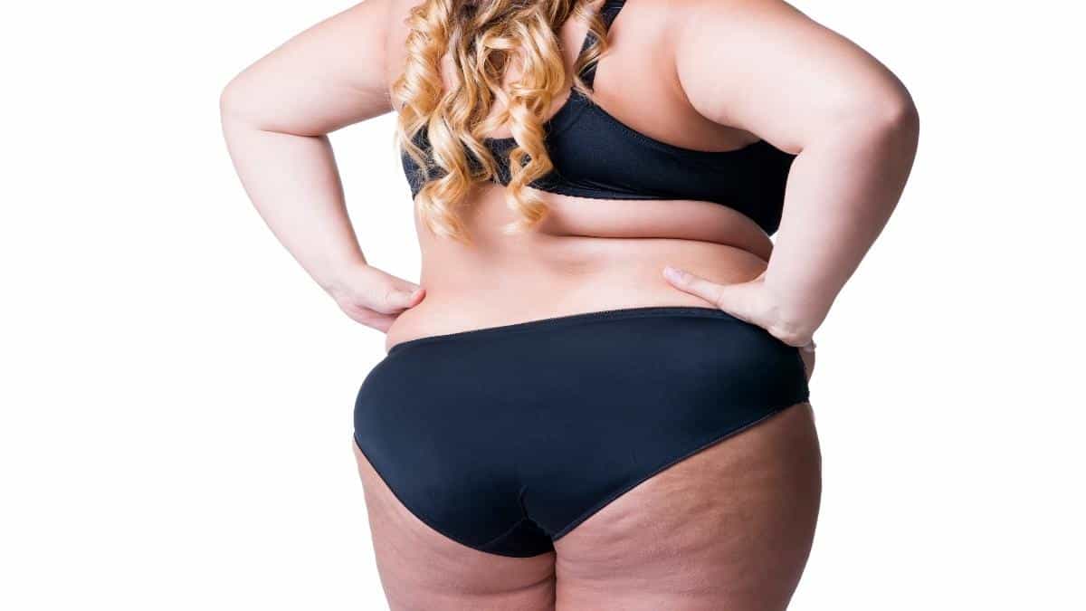 An overweight woman showing that she has 57 inch hips