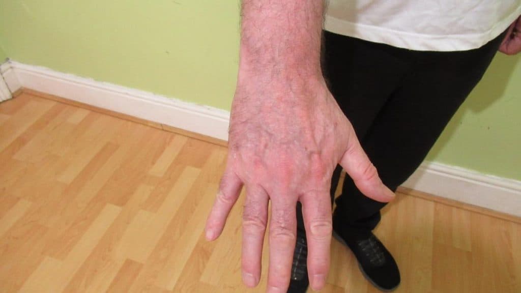 A man showing his big 7.5 inch wrist to the camera