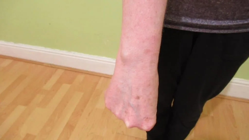 A woman showing that she has a small wrist circumference measurement