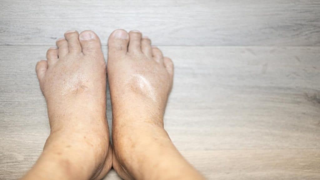 Close up of a person's 10 in ankles