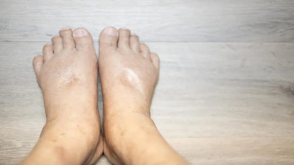 Close up of a person's 10 in ankles