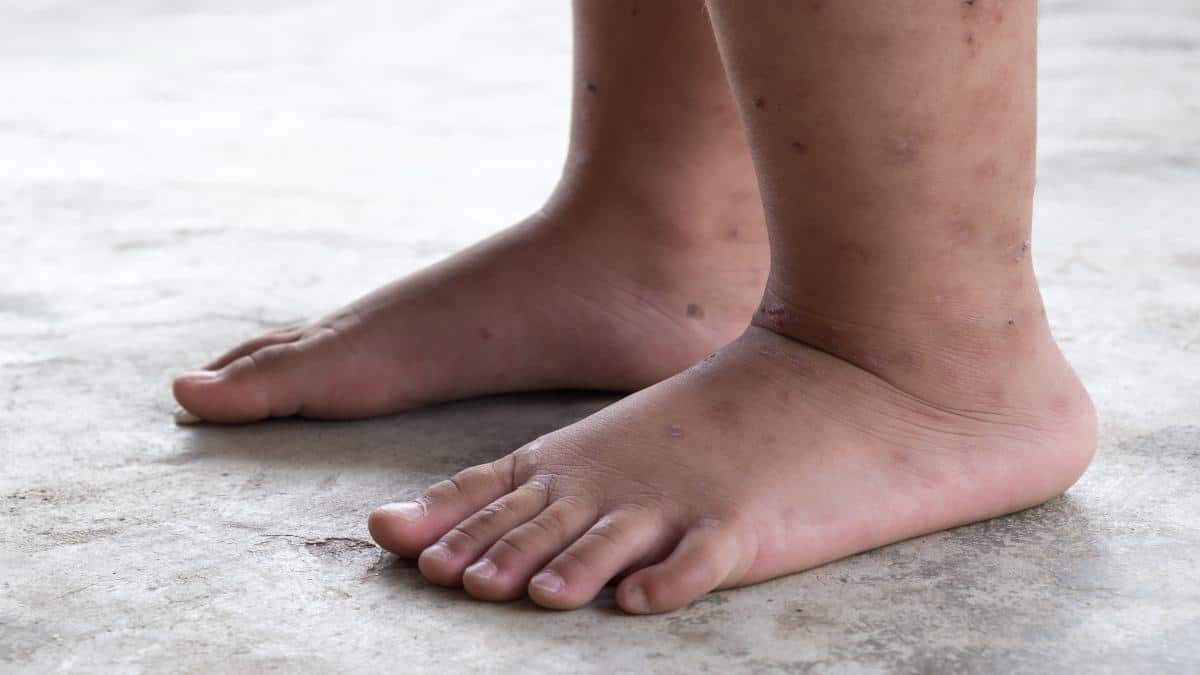 Close up of a person's 11 inch ankles