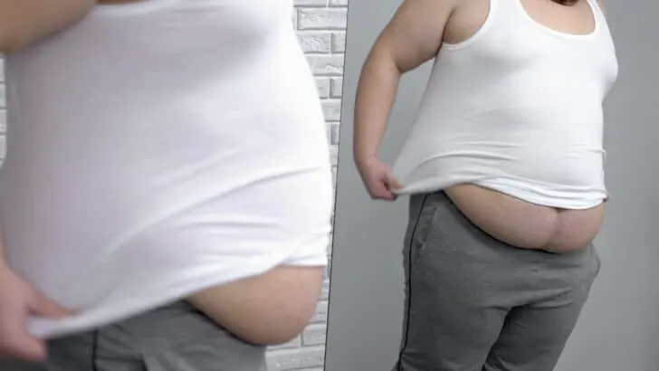 Is a BMI of 54 putting your health at risk?