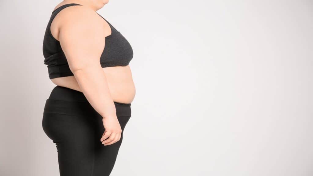 An overweight BMI 38 woman