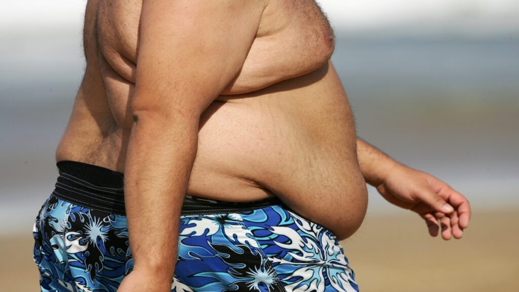 A BMI 50 man walking on the beach