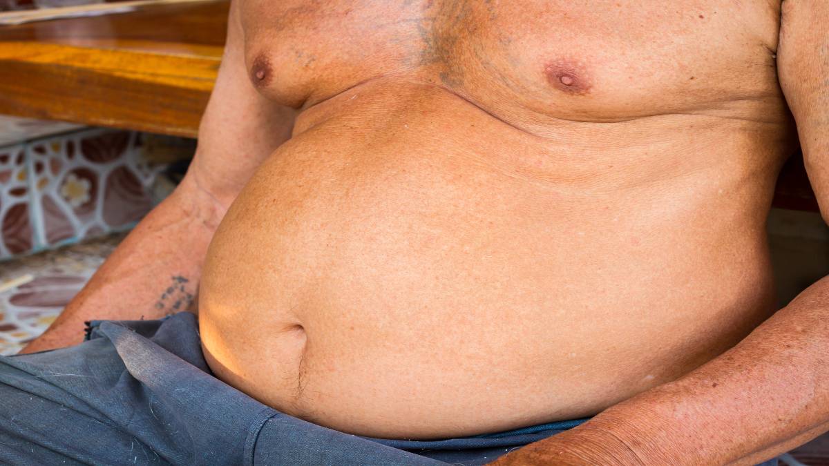 An overweight man who has a BMI of 40